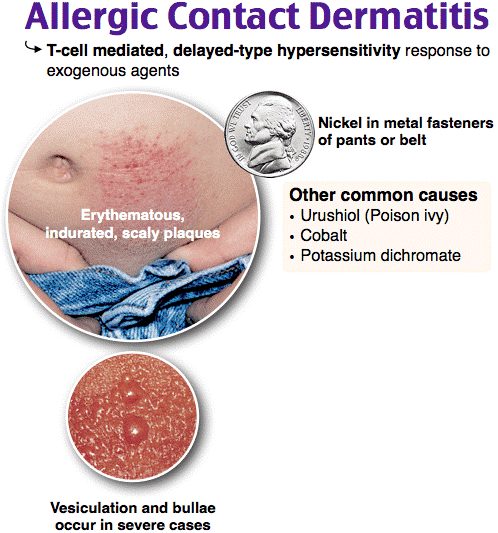 Sanitation & Disinfection